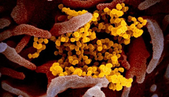 Uzman Mikrobiyolog: “Ölümcüllük oranı yüksek olmaz”
