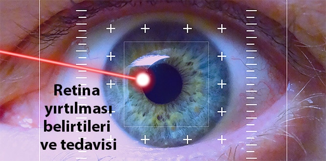 RETİNA YIRTIĞINDA ERKEN TEDAVİ UYARISI
