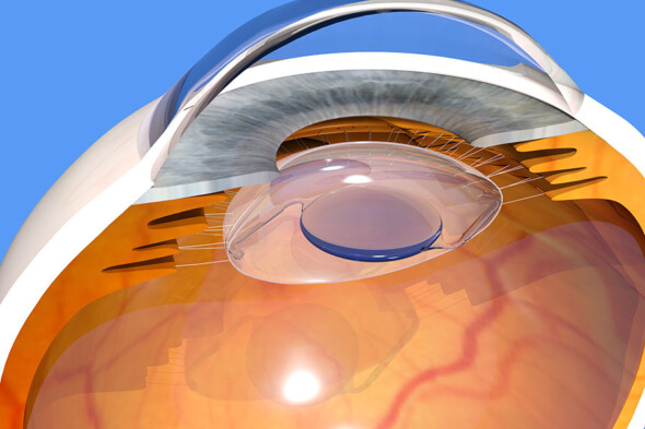 Sempozyumda Göz İçi Lenslerindeki Son Gelişmeler Konuşuldu
